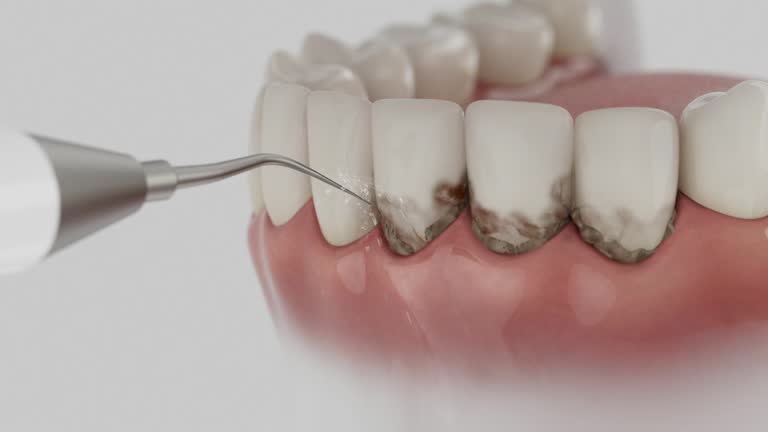 Reliable Dental contractor in Sewaren, NJ by Dentist Open Now